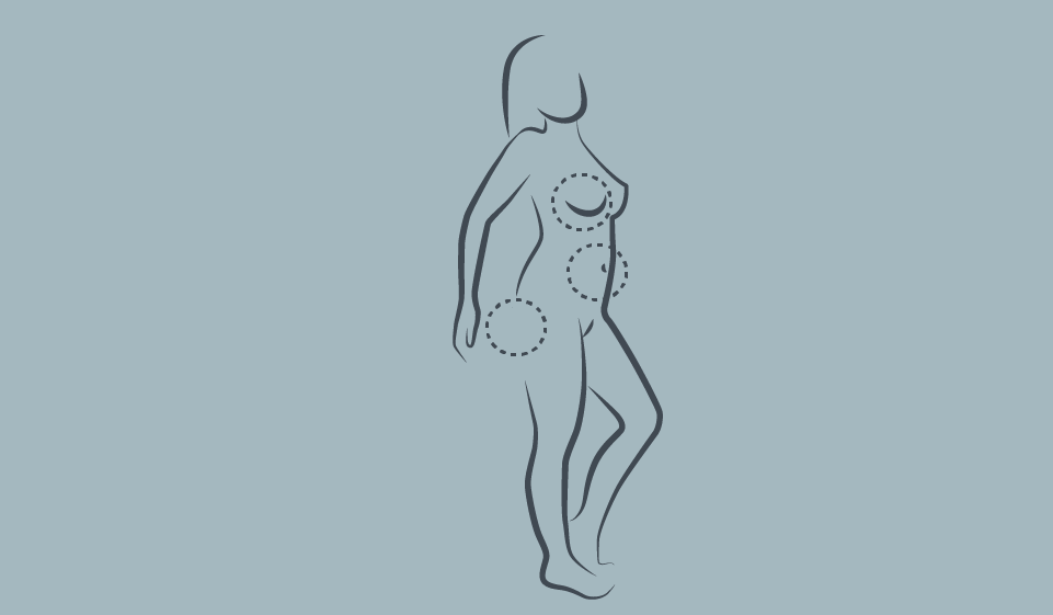 mommymakeover02