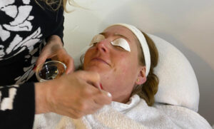 Hautstraffung mit Retinol-Peeling in der Docure Klinik Berlin